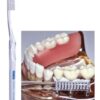 Vitis Implant Sulcular implantaat borstel 1 stuk Dentaid